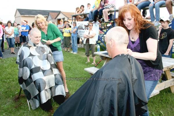 Going bald
